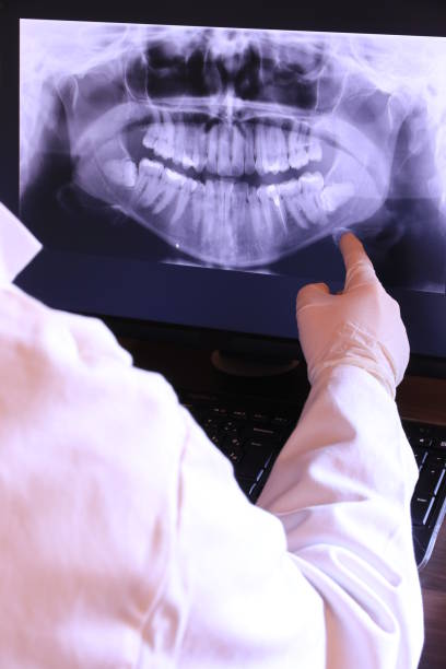 Best Emergency Denture Repair in Prunedale, CA
